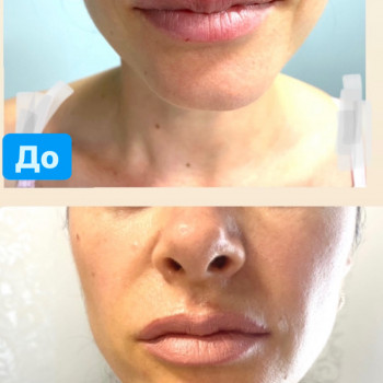 Наталія Бутенко, Полтава Фото - 60