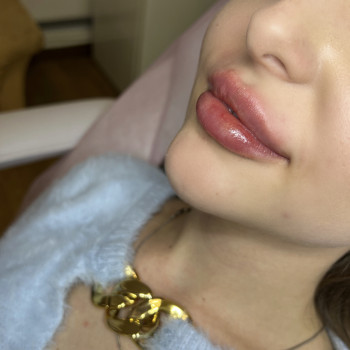 Увеличение губ
                    Косметолог Мария Киев