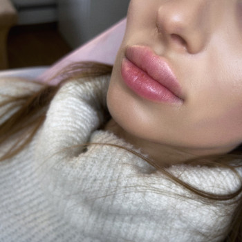 Увеличение губ
                    Косметолог Мария Киев