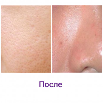 После чистки