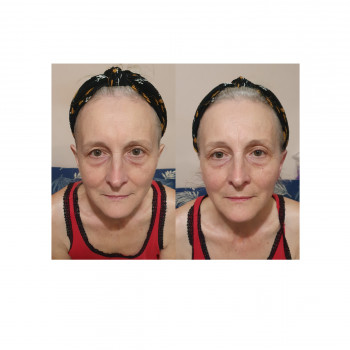 До та після масажу