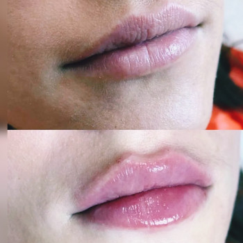 Татьяна Церпіцька, Житомир Фото - 5