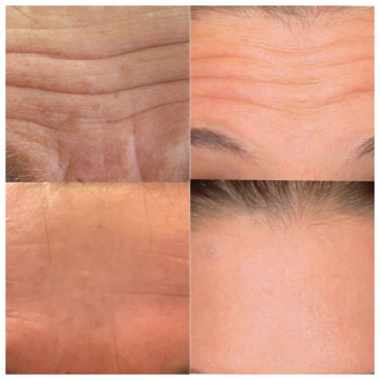 Татьяна Церпіцька, Житомир Фото - 6