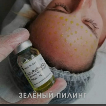 Пилинг
                    Косметолог Ольга Мелитополь