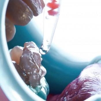 LK Dental Center, Луцьк Фото - 5