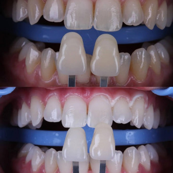 LK Dental Center, Луцьк Фото - 6