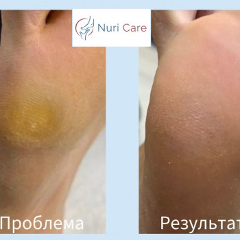 Мохамед Нури Хамдун, Вінниця Фото - 6