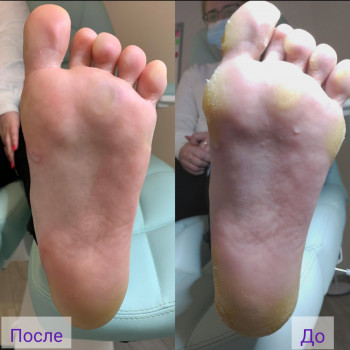 Мохамед Нури Хамдун, Вінниця Фото - 7