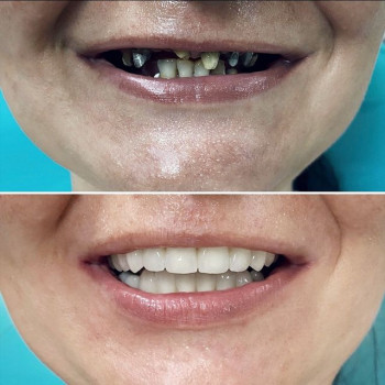 All Dent, Николаев Фото - 5