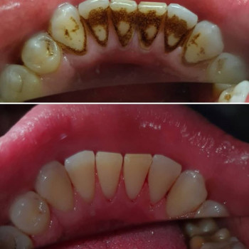 Белая Линия, Николаев Фото - 5