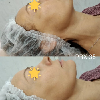 Наталія Вереда, Дніпро Фото - 9