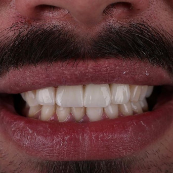 iDent, Кривой Рог Фото - 5