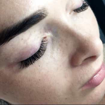 Классическое наращивание