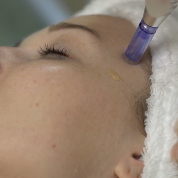 Фракционная мезотерапия Активатор матрикса Клеточная терапия AnubisMed Skin Regenerationg Coctail лицо
                    Косметолог-естетист Лариса Харків