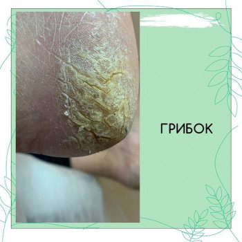 Оксана Ковалевская, Харків Фото - 6