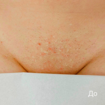 Ежикофф, Харьков Фото - 16