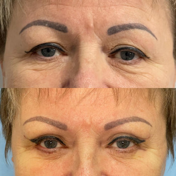 Абдель Эрритали, Харків Фото - 94