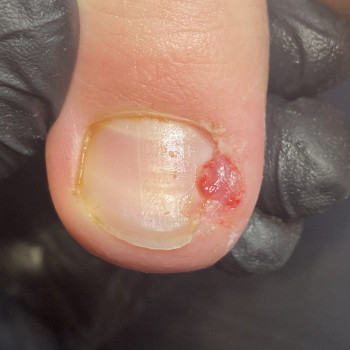 Фото из портфолио специалиста Євгенія Обух (подолог, Ивано-Франковск)