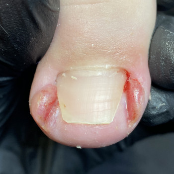 Фото из портфолио специалиста Євгенія Обух (подолог, Ивано-Франковск)