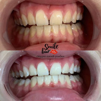 Smile Bar, Маріуполь Фото - 5