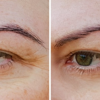 Empyreal Бюти Центр, Львів Фото - 6