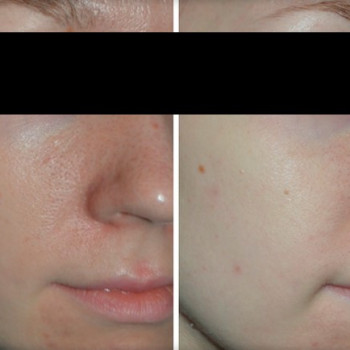 Empyreal Бюти Центр, Львів Фото - 7