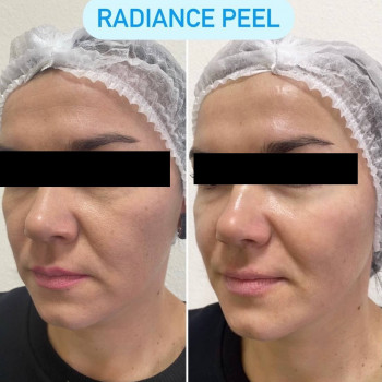 Empyreal Бюти Центр, Львів Фото - 8