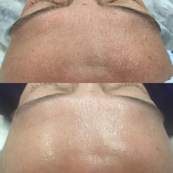 Empyreal Бюти Центр, Львів Фото - 9