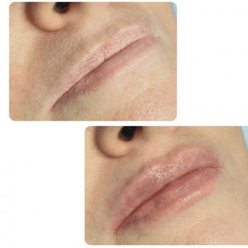 Аніко Естетік, Рівне Фото - 6