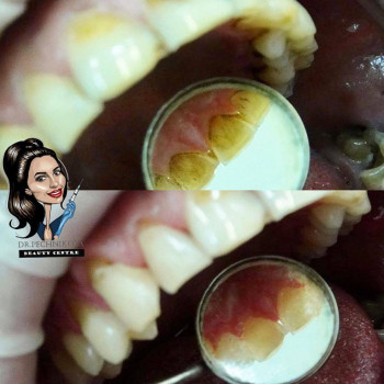 RoDent, Рівне Фото - 5