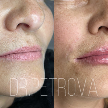 Анастасия Петрова, Кропивницький Фото - 5