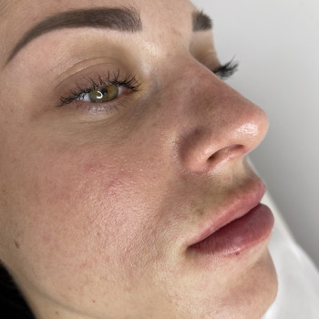 Анастасия Петрова, Кропивницький Фото - 7