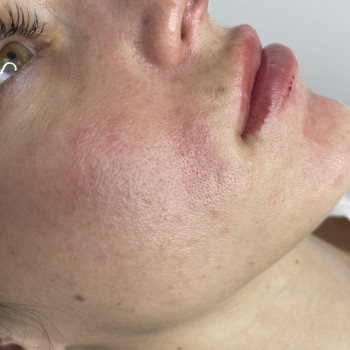 Анастасия Петрова, Кропивницький Фото - 8