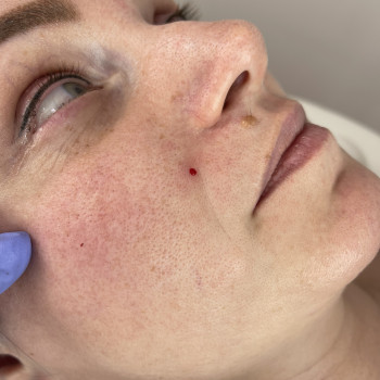 Анастасия Петрова, Кропивницький Фото - 11