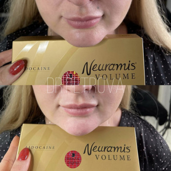 Анастасия Петрова, Кропивницький Фото - 15