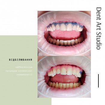 Dent Art Studio, Ровно Фото - 5