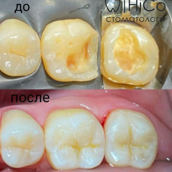 НіСо, Сумы Фото - 5