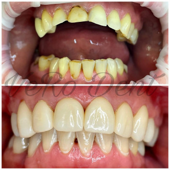 Vero Dent, Сумы Фото - 5