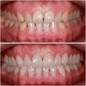 Стоматологія Нечай, Тернопіль Фото - 6