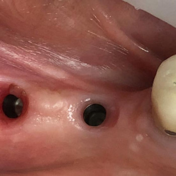 Mira Dent, Тернопіль Фото - 6