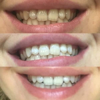 Max dent, Тернопіль Фото - 5