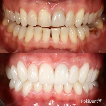 Pokident, Тернополь Фото - 5