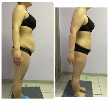 Ксения Масажист, Борисполь Фото - 13