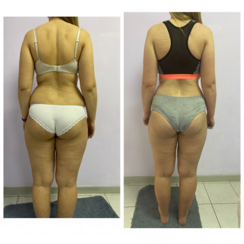 Ксения Масажист, Борисполь Фото - 15