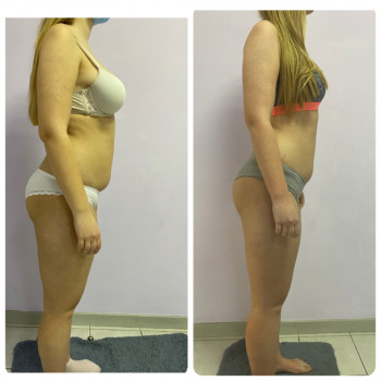 Ксения Масажист, Борисполь Фото - 16