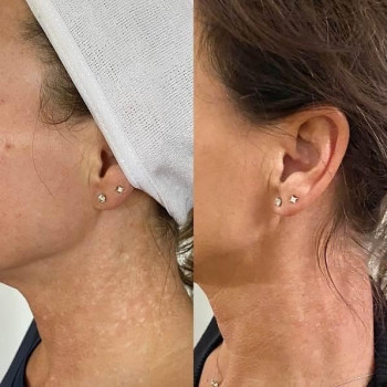 Лилия Заморская, Киев Фото - 21