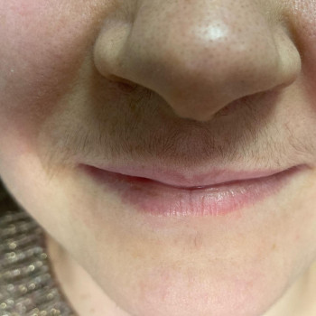 Наталія Костюк, Рівне Фото - 7