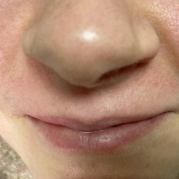 Наталія Костюк, Рівне Фото - 6