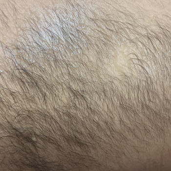 Наталія Костюк, Рівне Фото - 5