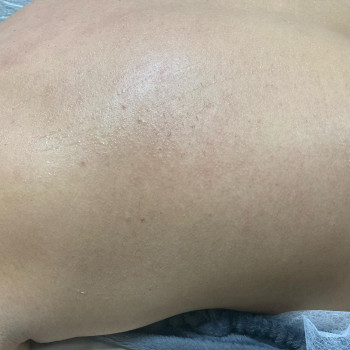 Наталія Костюк, Рівне Фото - 4